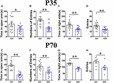 Elevated Level of PKMζ Underlies the Excessive Anxiety in an Autism Model